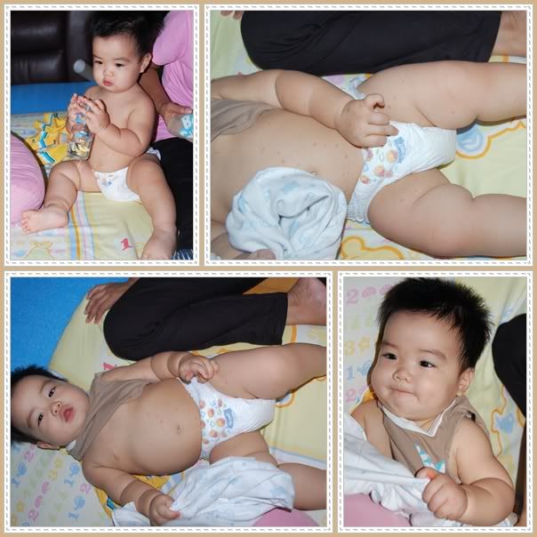 อาร์มี่เป็นตุ๊กแกน้อย ส่าไข้