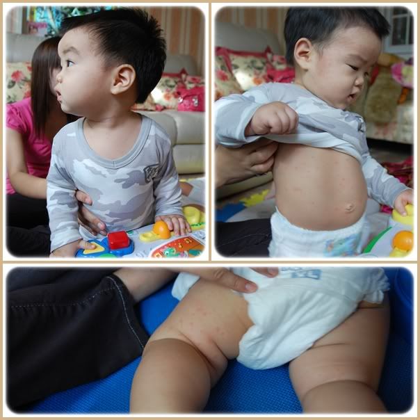 อาร์มี่เป็นตุ๊กแกน้อย ส่าไข้