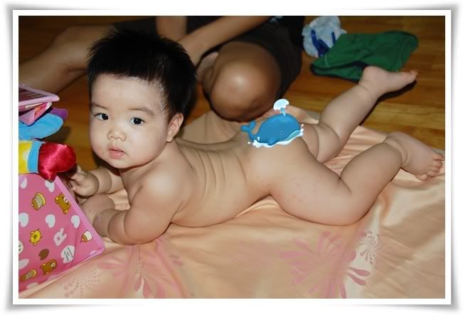 อาร์มี่เป็นตุ๊กแกน้อย ส่าไข้