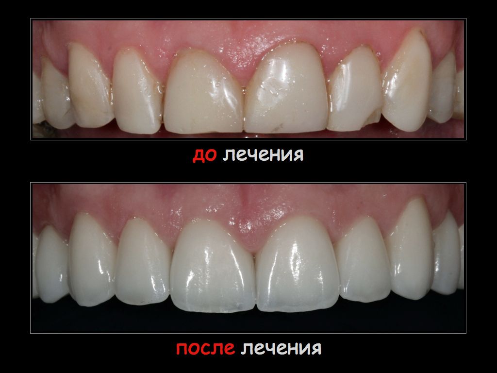 Как сшить комбинезон для йорка Как сшить комбинезон для йорка